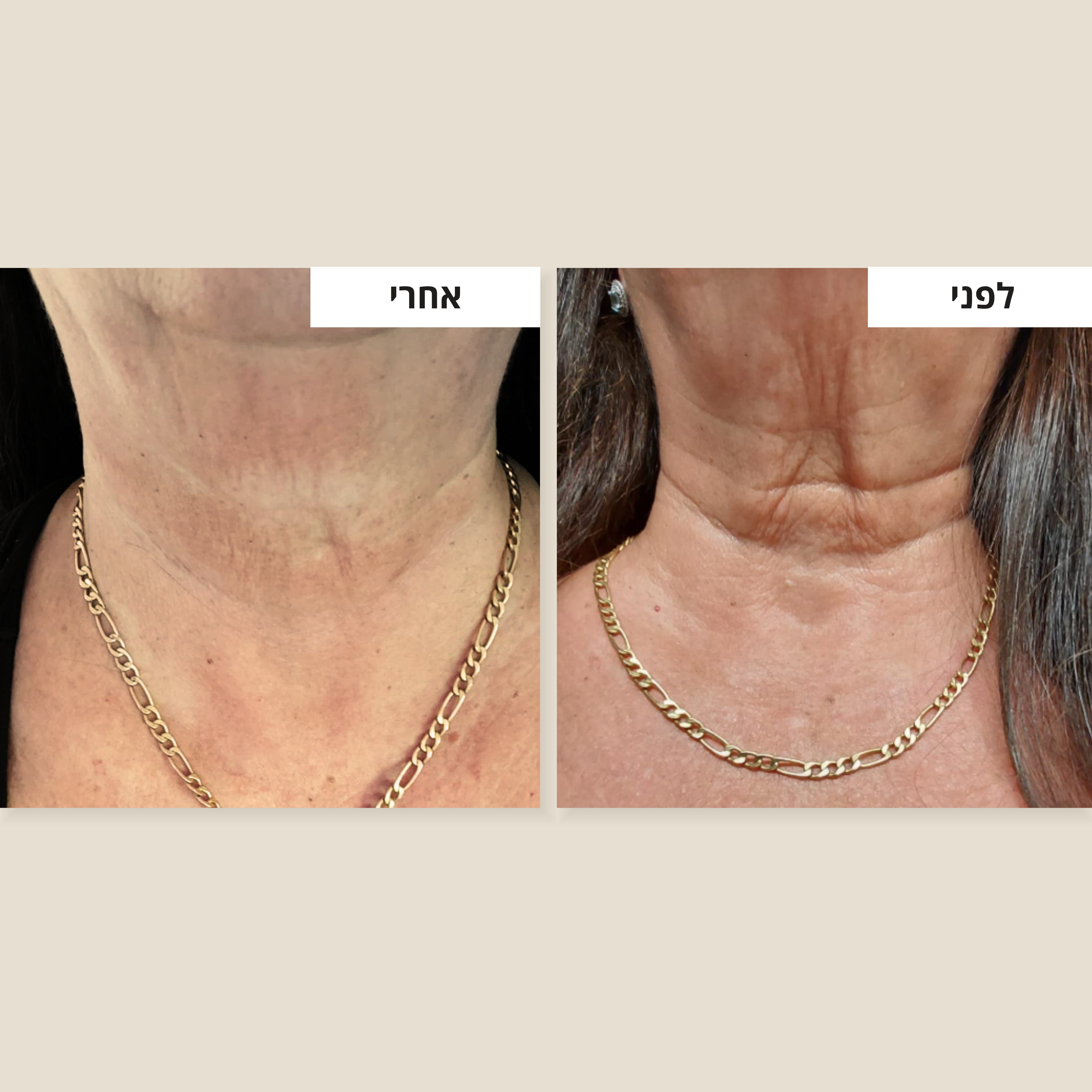 קרם רטינול וקולגן עם 8% חומצה היאלורונית