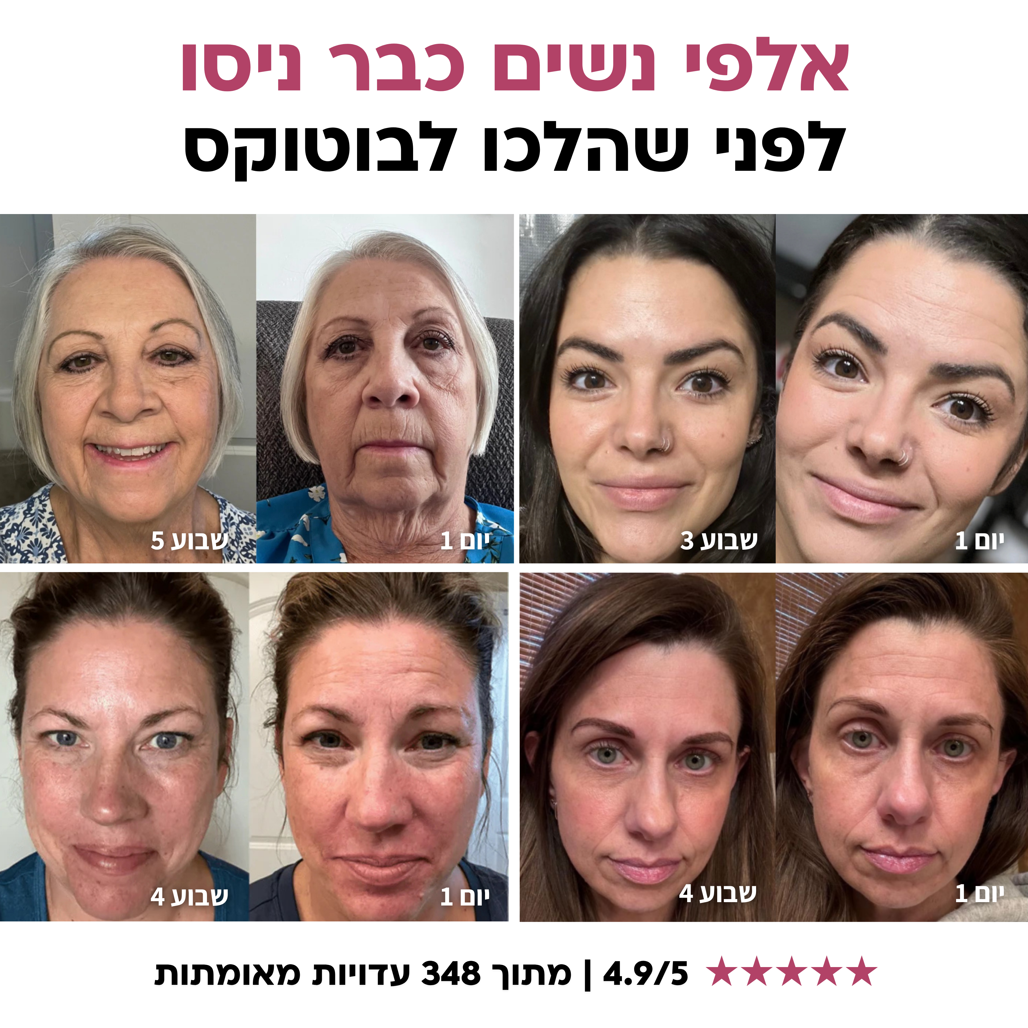 VERRA | קרם אנטי אייג׳ינג
